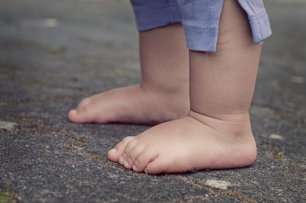 幼児のアトピーによる手足のかゆみ対策は？