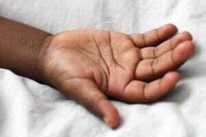 アトピーの幼児に最適な食事対策は何ですか？